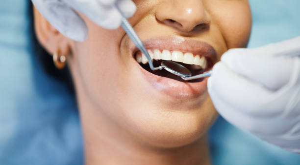 Best Emergency Dentist for Lost Fillings or Crowns in Minerva Park, OH