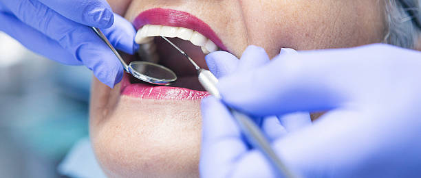 Best Mobile Emergency Dentist in Minerva Park, OH